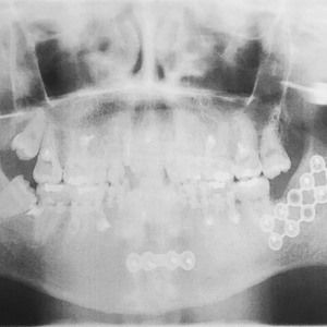Meet your Posher, Bradley